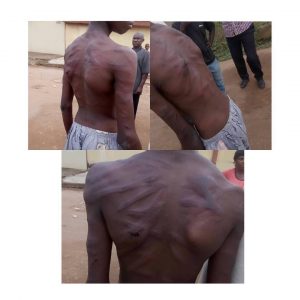 Boy brutalized by his uncle in Lagos