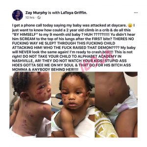 Lady reveals what a 2-yr-old did to her baby at a U.S daycare
