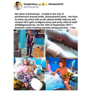 Student who lost his leg and was abandoned after being shot by some Nigerian soldiers, cries out. [Swipe]