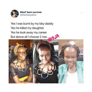 My baby daddy killed my daughter, burnt me, but I choose to rise - S. African lady