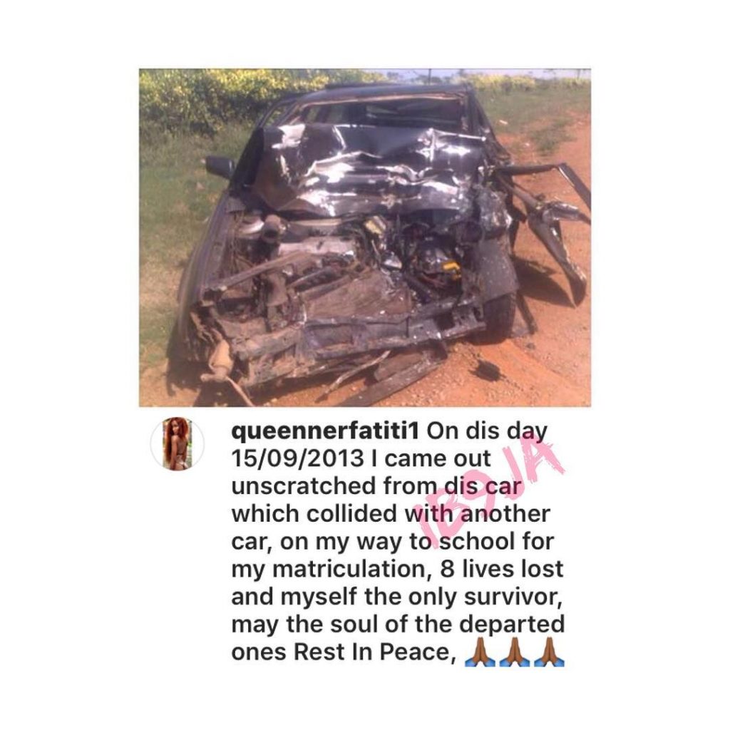 Nigerian model marks 5yrs of surviving a fatal accident that claimed the lives of everyone else