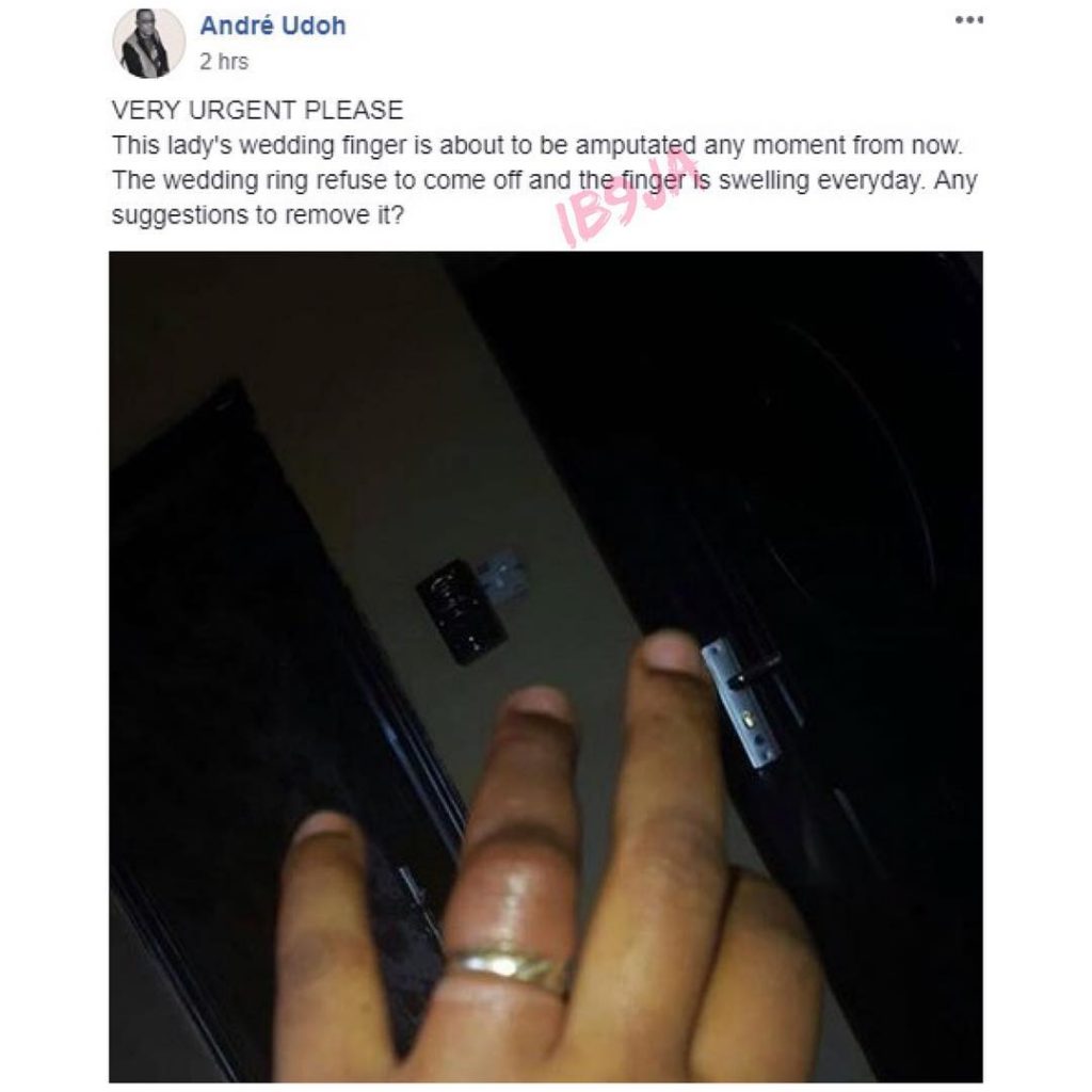 Nigerian lady’s finger set to be amputated because of her wedding ring