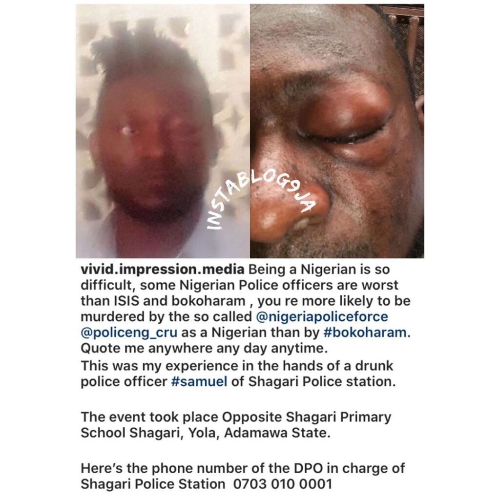 Filmmaker Obaji reveals what a drunk policeman did to him in #Yola, #AdamawaState. [Swipe]