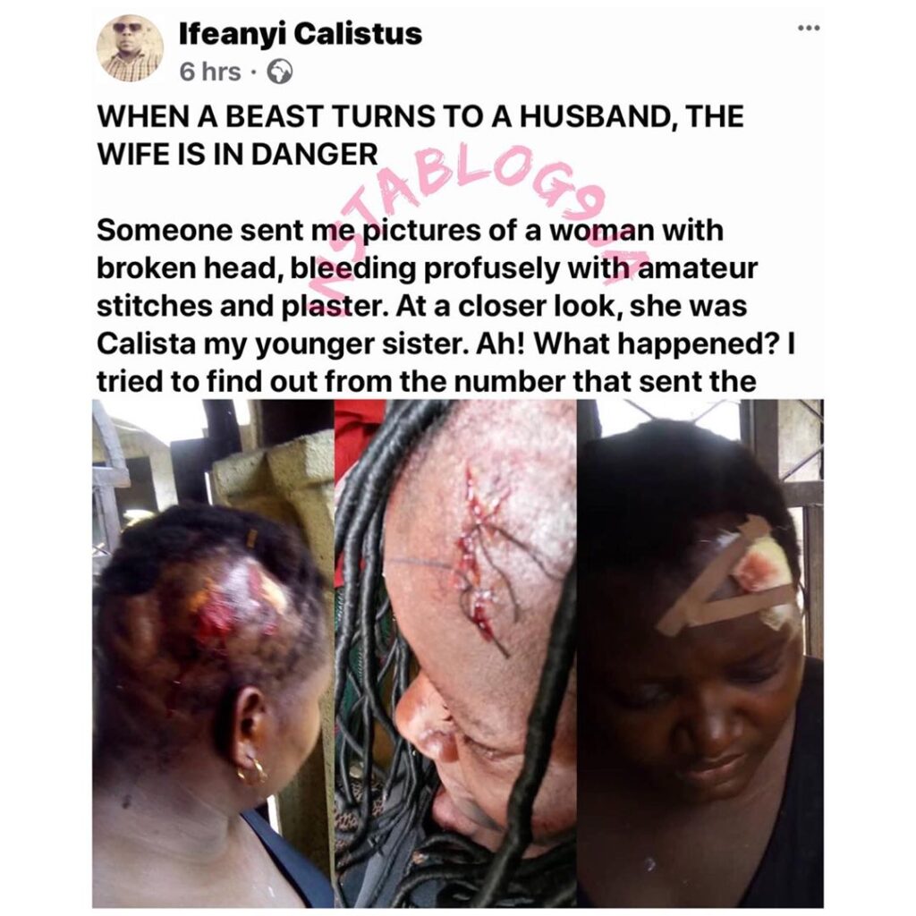 Graphic: Man uses pestle to break his wife’s head during a disagreement over bucket. [Swipe]
