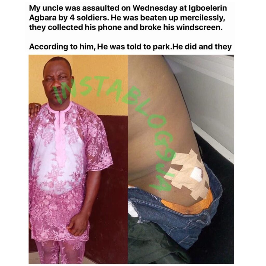 Army officers allegedly assault man and leave him for dead in Ogun State [Swipe for GRAPHIC content ]