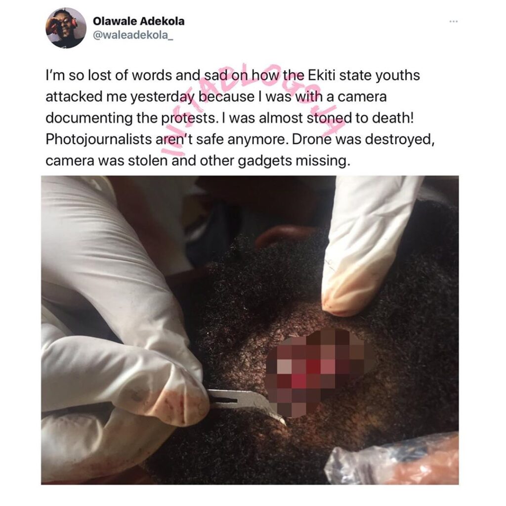 Photographer shares #EndSARS protest story [Swipe for GRAPHIC content ]