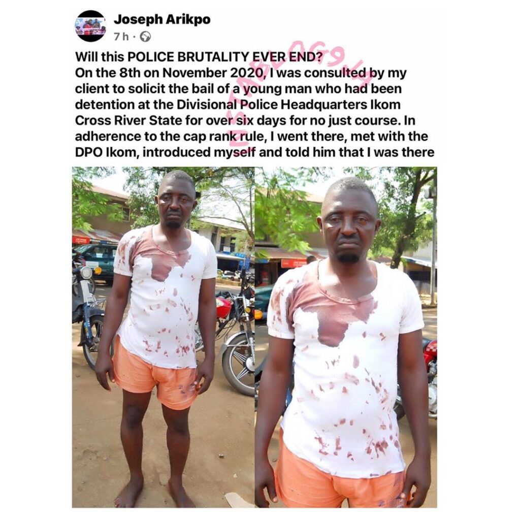 Lawyer handcuffed, battered for telling a drunk police DPO not to call him ‘stupid.’ [Swipe]