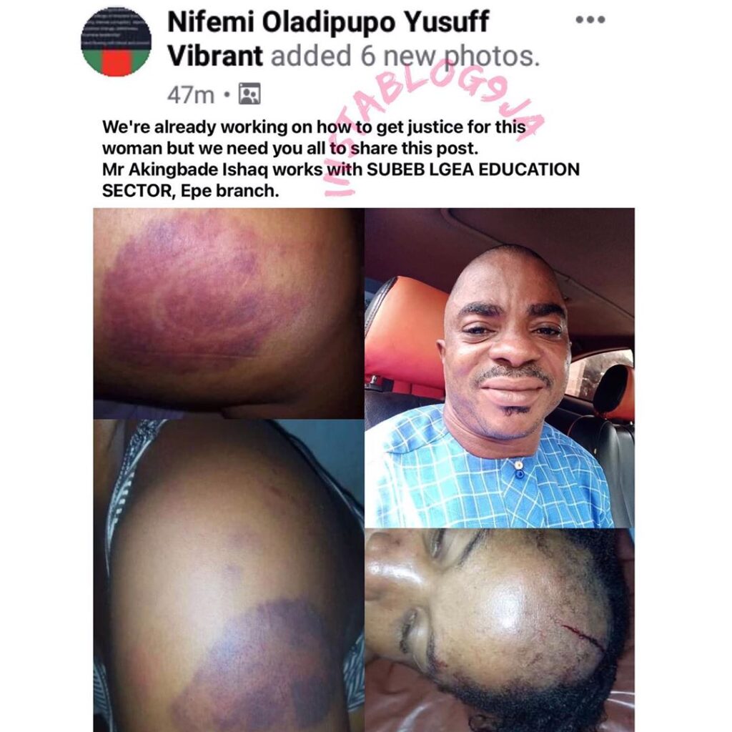 Graphic content - Man called out for allegedly brutalizing his wife in Lagos. [Swipe for GRAPHIC content]