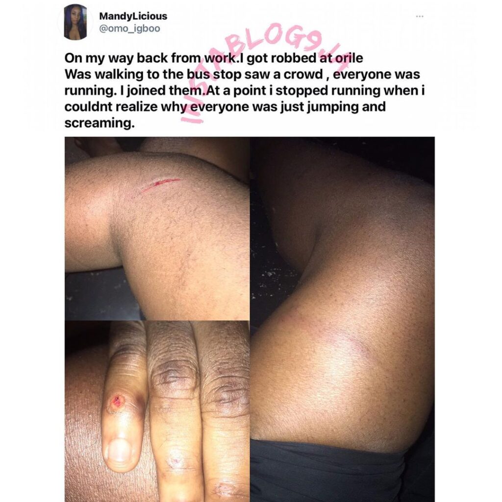 Lady reveals how she was robbed and ignored by passers-by and the police in Orile, Lagos. [Swipe]