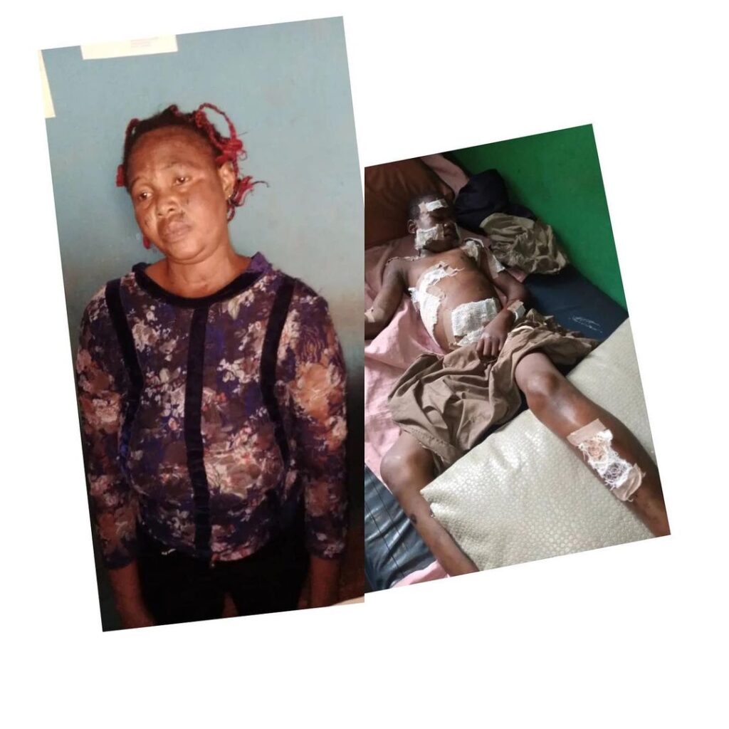 Lady uses hot knife to inflict injuries on her 12-yr-old in-law over missing N5,000