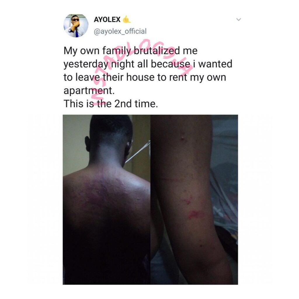 25-year-old man allegedly brutalized by his family for wanting to move out of the house [Swipe]