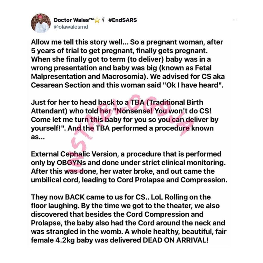 After a 5-yr wait to have a child, pregnant lady loses her child because she objected to C-section [Swipe]