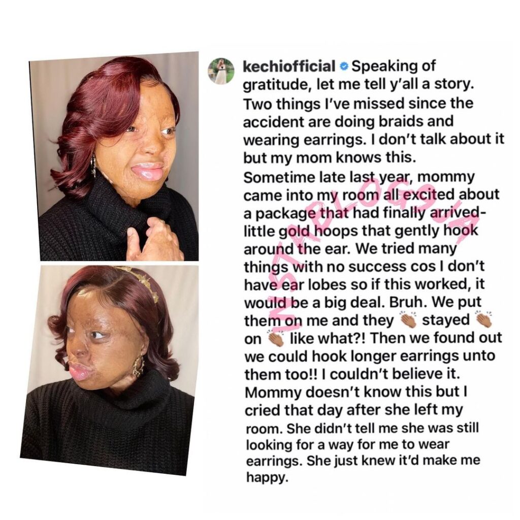 Singer Kechi grateful for being able to wear earrings again after losing her ear lobes in the Sosoliso plane 15 years ago