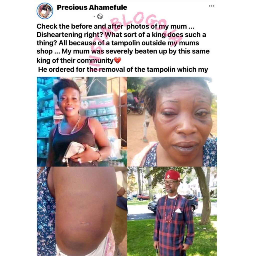 Lady calls out a monarch who allegedly ordered the assault of her mom in Imo State [Swipe]