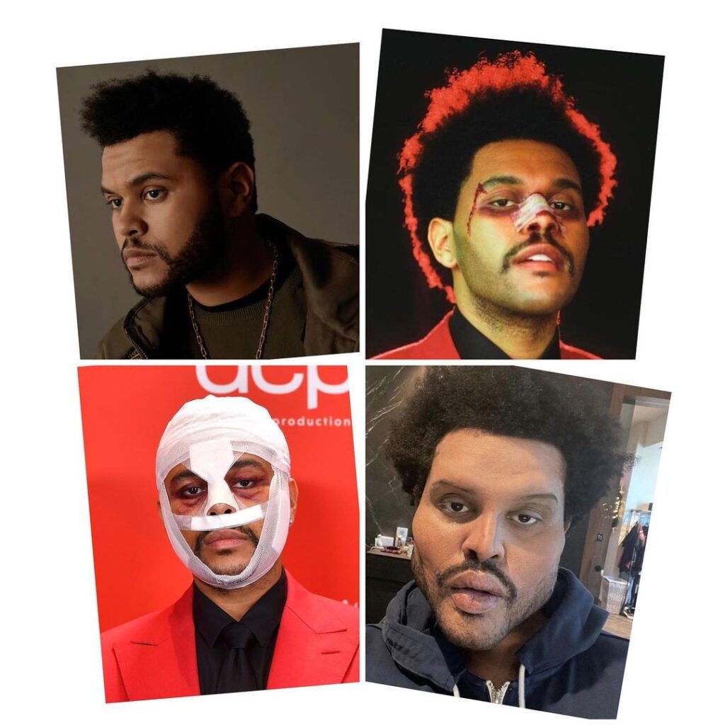 American Singer, TheWeeknd leaves the world in shock as he debut new face