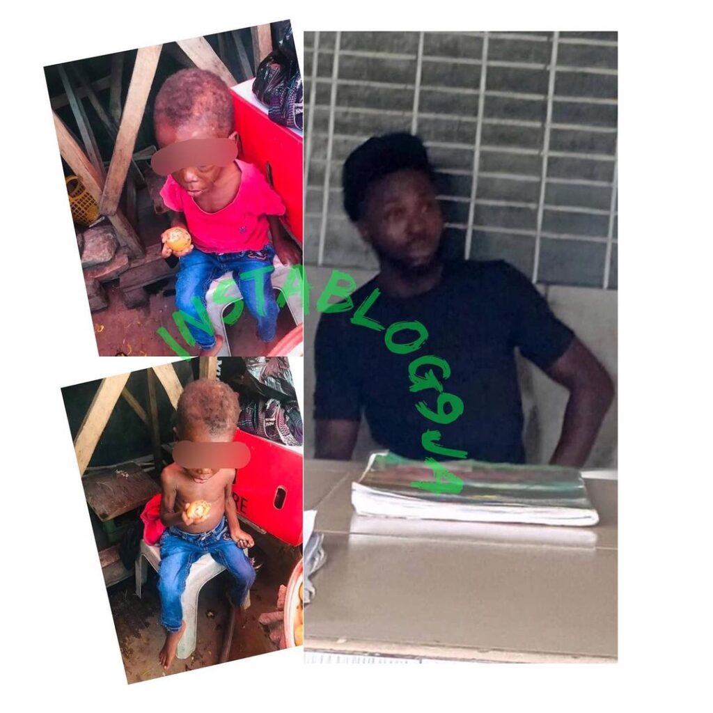 2yr old boy allegedly maltreated by his father and step-mother,rescued in Warri