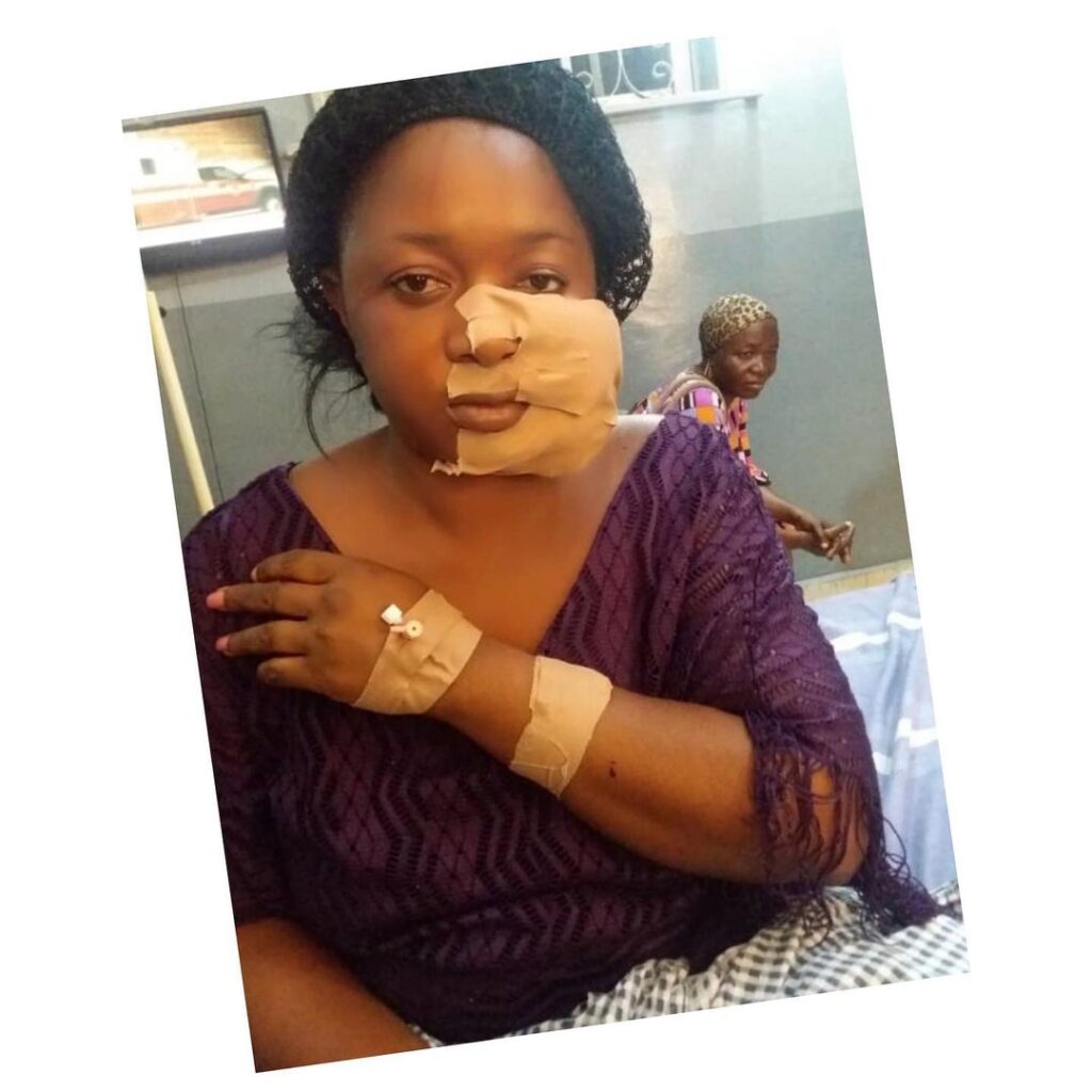 GRAPHIC: Lagos landlord and his wife disfigure tenant's face over ‘quit notice’