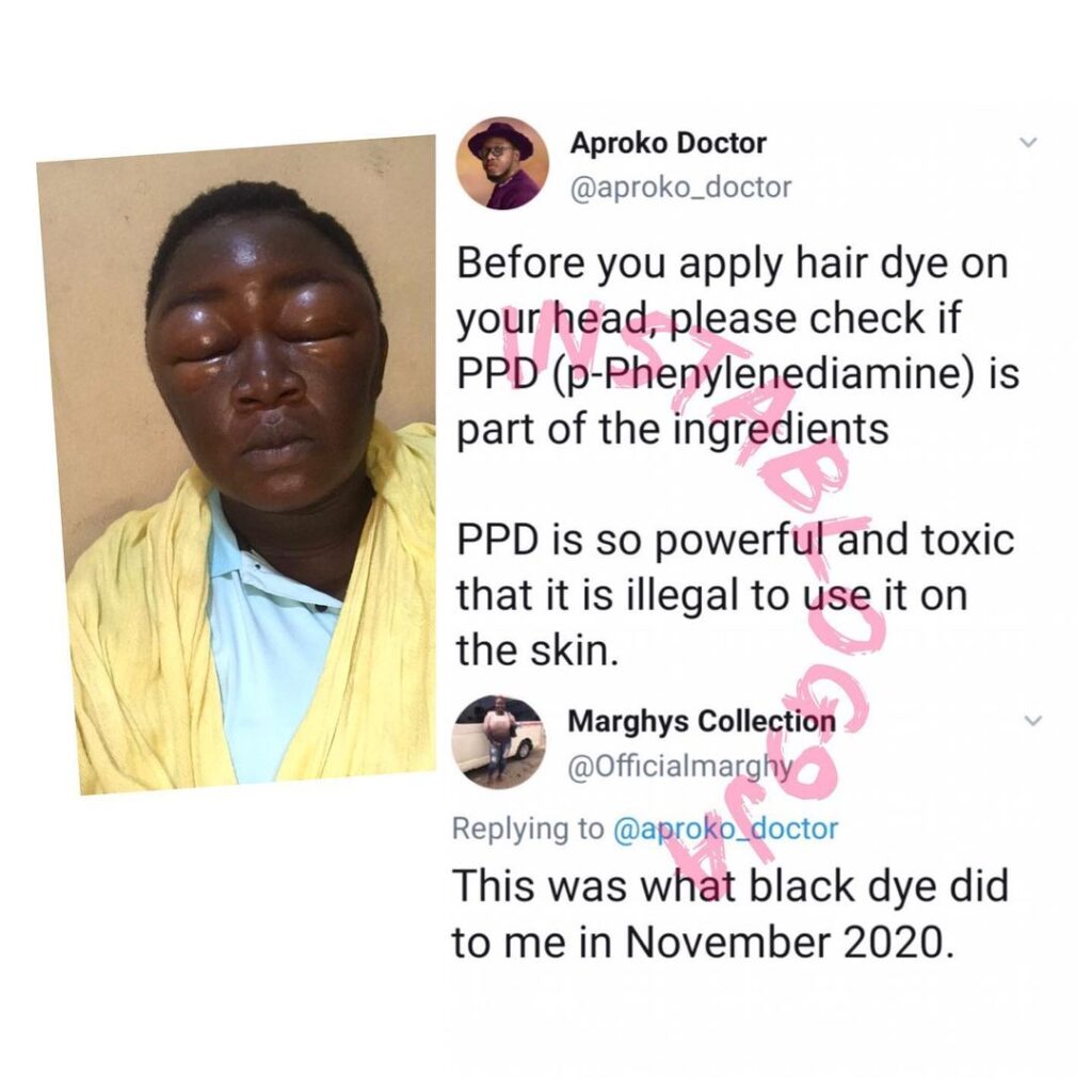 Businesswoman reveals what hair dye did to her few months ago