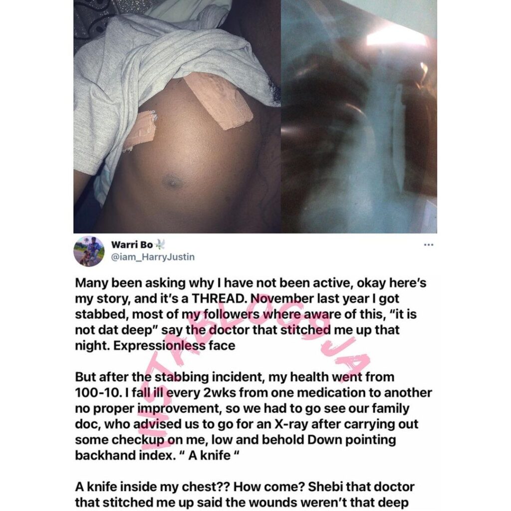 Man recounts how a knife was forgotten inside his body after being stabbed [Swipe]