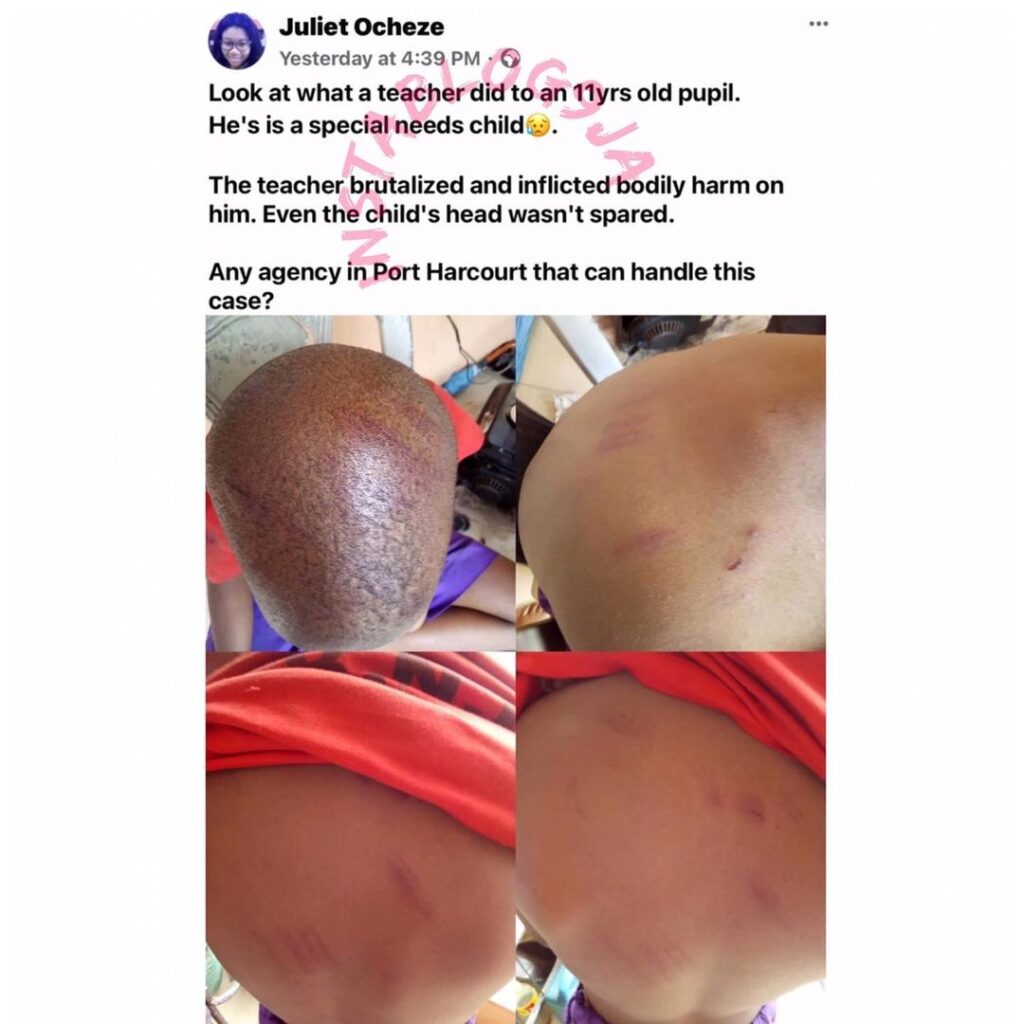 Teacher brutalizes an 11-yr-old special-needs student in PH, Rivers State