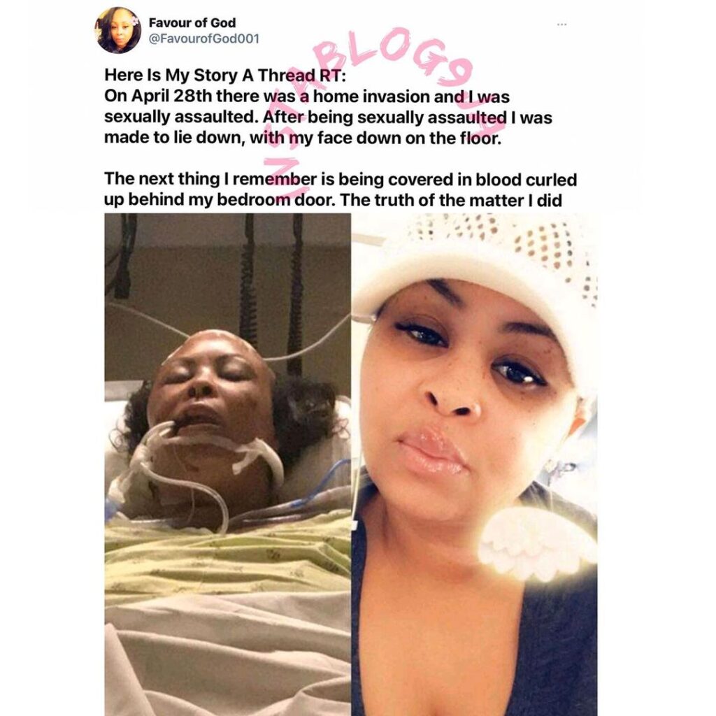 Lady narrates her amazing experience with God after being sexually assaulted and shot by robbers. [Swipe]