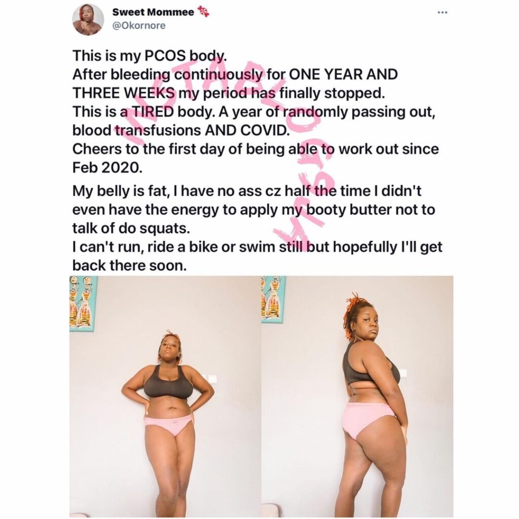Lady celebrates her body after bleeding for one year and three weeks