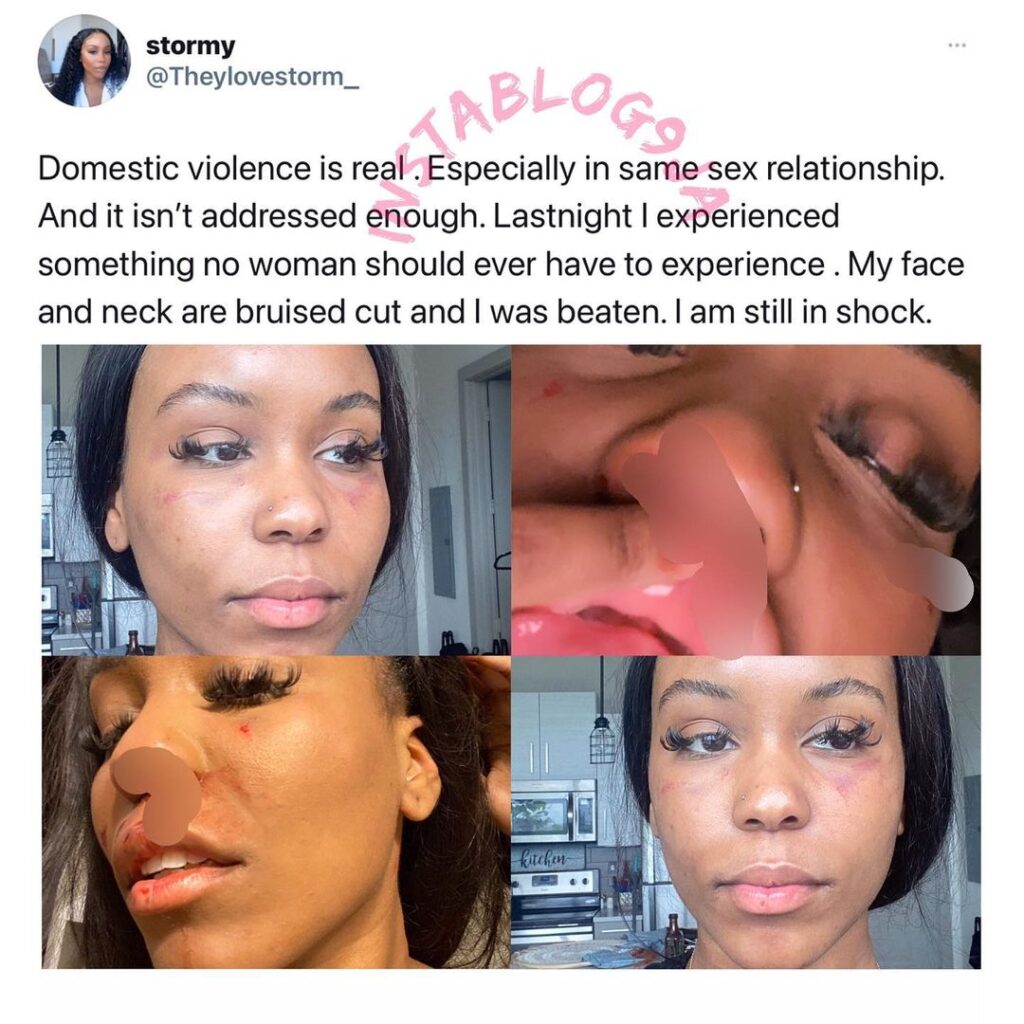 Graphic: “Domestic violence is real in same-s*x relationships,” says lady who was assaulted by her partner [Swipe]