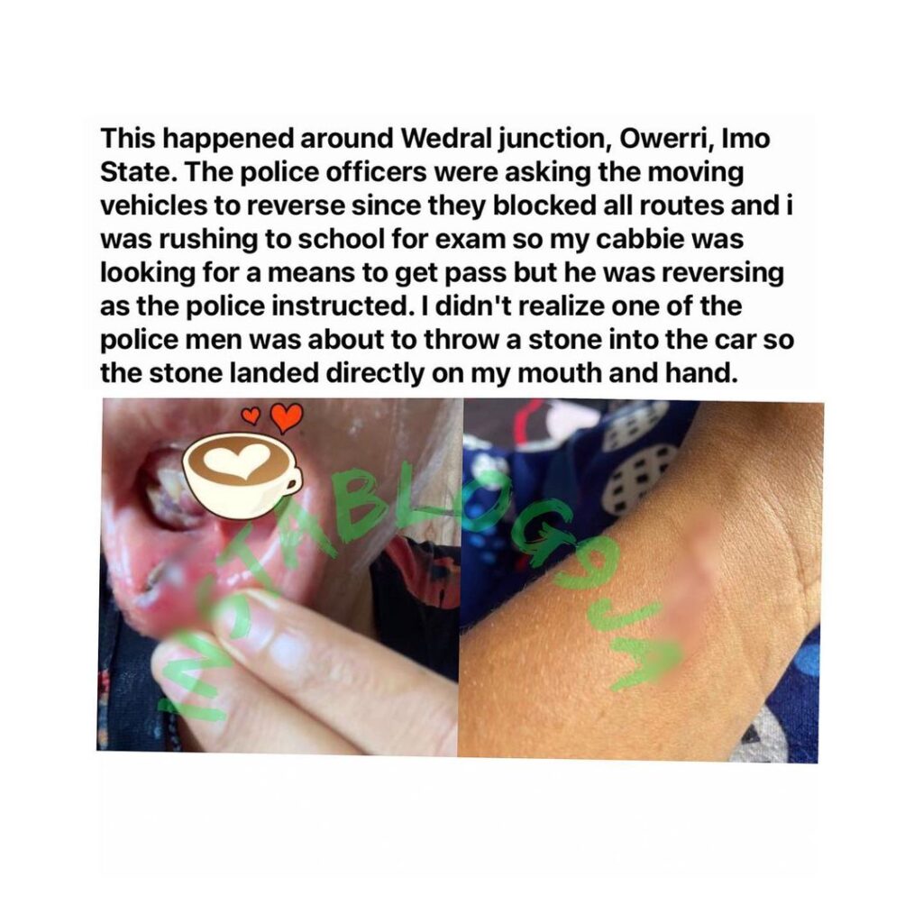 Lady suffers severe mouth injury after a police officer attacked her with a stone in Imo. [Swipe]