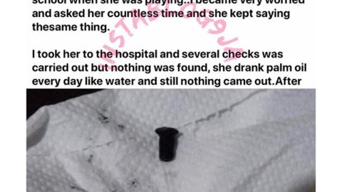 8 months later, 3-yr-old girl vomits the nail she swallowed while playing in school. [Swipe]