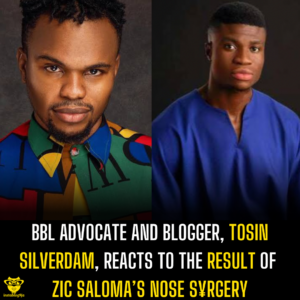 BBL advocate and blogger, Tosin Silverdam, reacts to the result of Zic Saloma’s nose s¥rgery